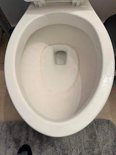 How To Remove Hard Water Stains From A Toilet Bowl